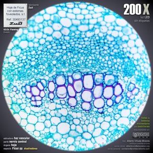 Nervio central: haz vascular